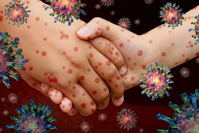 Biện pháp ngừa virus corona an toàn là vệ sinh tay thật sạch sẽ