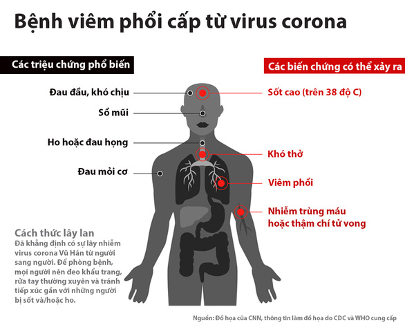 Biểu hiện của bệnh cúm do virus corona